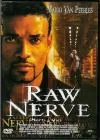 Raw nerve