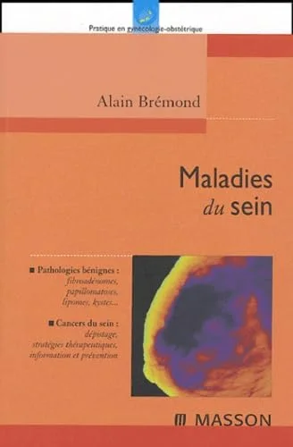 Maladies du sein