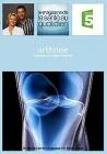 L'arthrose