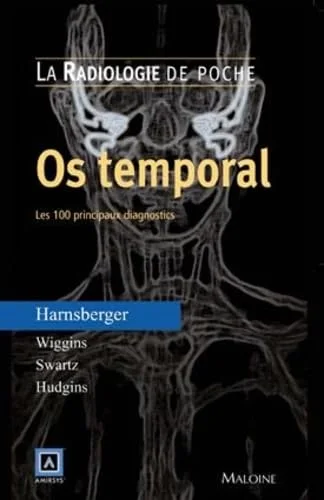 Os temporal : Les 100 principaux diagnostics