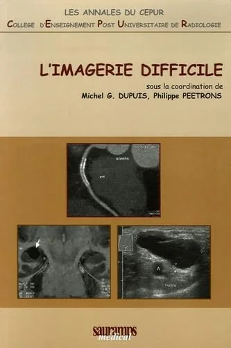 L'imagerie difficile ou
