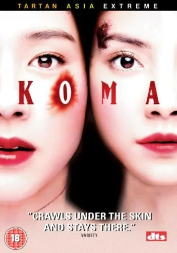 Koma