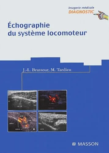 Echographie du système locomoteur