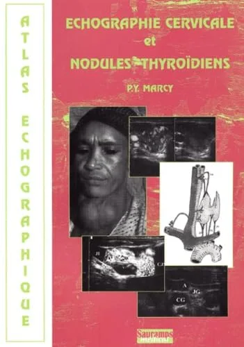 Echographie cervicale et nodules thyrodiens